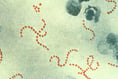 Strep A: Welsh Government working to maintain supplies of penicillin 