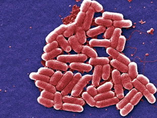 Food poisoning outbreak hits Abergavenny